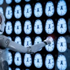 AI диагностика глиобластомы фото